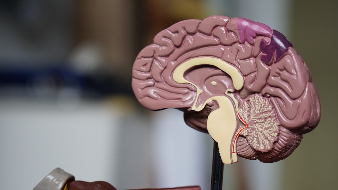 Average Settlement for Traumatic Brain Injury Cases from the DBA